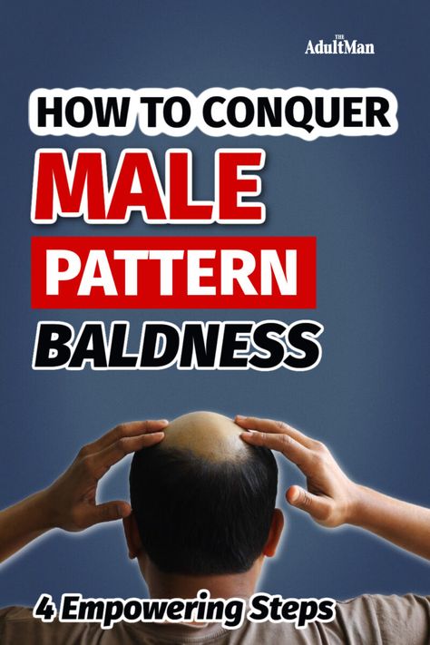 Are you experiencing male pattern baldness? You're not alone. Learn how to accept and overcome men's hair loss through in four simple and inexpensive steps. Male Pattern Baldness Hairstyles, Homemade Hair Mask, Hair Growth Spray, Male Pattern Baldness, Pattern Baldness, Bald Hair, Regrow Hair, Black Men Hairstyles, Lost Hair