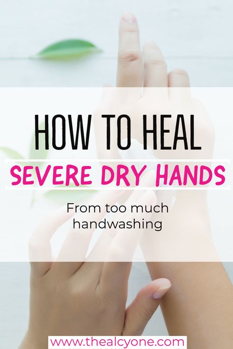 Dry Cracked Hands Remedy, Cracked Hands Remedy, Chapped Hands Remedy, Dry Hands Remedy, Extremely Dry Hands, Itchy Hands, Hand Care Routine, Dry Hand Skin, Hand Soak