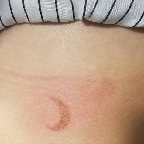 Jasmine Waller on Instagram: "This client wanted her tattoo very subtle. So we decided to make it look like a birthmark. I think this little moon is ADORABLE !" Tattoos Around Birthmarks, Birth Mark Tattoo Ideas, Moon Birthmark, Cute Birthmarks, Targaryen Child, Little Moon Tattoo, Tattoo Mole, Birthmark Tattoo, Birth Marks