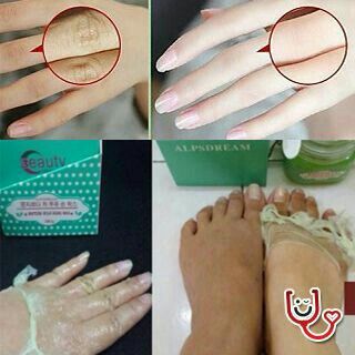 Face Tone, White Skin Tone, Diy Kosmetik, Dead Cells, Beauty Remedies, Peel Off Mask, Homemade Face Masks, Skin Remedies, Homemade Face