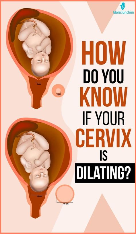 Cervix dilation is the opening of the cervix, the neck of the uterus, during childbirth. Body changes during the labor process to allow the baby to pass through the birth canal. Although it is exciting to hold the baby, many women may be nervous and worry about the labor pain and delivery near the due date. Knowing these changes may help them to stay calm. Cervix Dilation Chart, Dilation Chart, Cervical Effacement, Dilation And Effacement, Cervix Dilation, Labor Inducing Exercises, Mucus Plug, Pregnancy Workout Videos, Pregnancy Pain