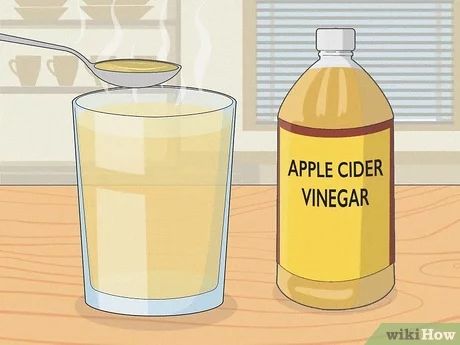 4 Ways to Soothe an Itchy Throat - wikiHow Itchy Throat Remedy, Home Remedies For Allergies, Home Remedies For Warts, Sinus Infection Remedies, Scratchy Throat, Throat Remedies, Sore Throat Remedies, Sore Throat And Cough, How To Stop Coughing