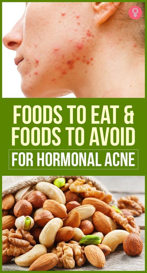 Are you struggling with hormonal acne?

Here are the foods you should eat and avoid to help clear your skin:

 Eat plenty of fruits and vegetables. These foods are packed with vitamins, minerals, and antioxidants that can help improve your skin health.
 Avoid processed foods, sugary drinks, and unhealthy fats. These foods can aggravate acne.
 Include healthy fats in your diet. Healthy fats, such as those found in Good Face Wash, Food For Acne, Acne Beauty, List Of Food, Acne Diet, Good Face, Foods For Healthy Skin, Skin Diet, Best Face Wash