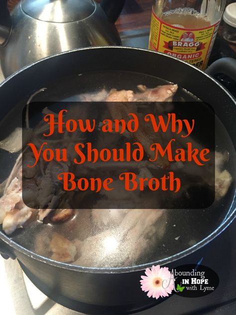 How To Boil A Whole Chicken For Soup, Boiling Chicken For Soup, Boil Whole Chicken, Chicken Breast Soup, Chicken Bone Broth Recipe, Make Bone Broth, Making Bone Broth, Chicken Broth Recipes, Homemade Chicken Soup