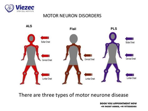 Motor Neurone Disease, Motor Neuron, Medical Health Care, Stem Cell Therapy, Stem Cells, The Brain, Chronic Illness, Some People, Love Life