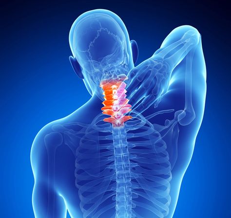 Neck Sprain, Forward Head Posture Exercises, Cervical Disc, Neck And Shoulder Muscles, Neck Traction, Cervical Traction, Chiropractic Clinic, Musculoskeletal Pain, Spinal Injury