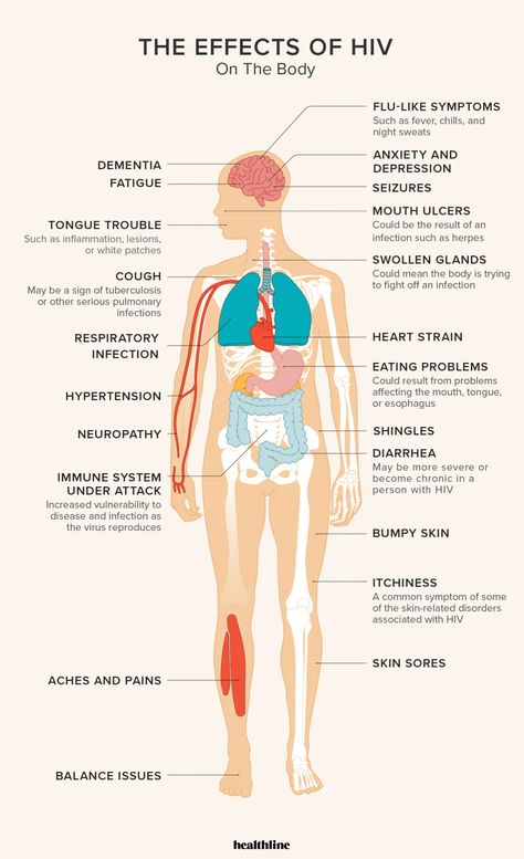 The Effects of HIV on the Body: Immune System and More Oral Care Routine, Gum Care, Oral Health Care, Aids Hiv, Fitness Advice, Tooth Decay, Oral Health, Oral Care, Cavities