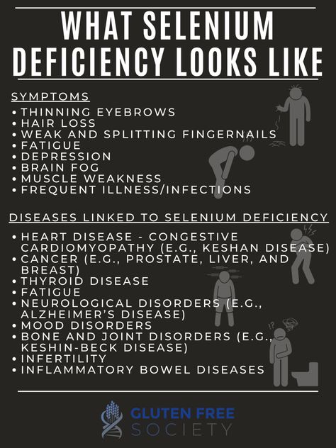 Does Gluten Cause Selenium Deficiency - Gluten-Free Society Selenium Deficiency Symptoms, Selenium Deficiency, Deficiency Symptoms, Thyroid Healing, Sick Remedies, Hashimotos Disease, Thyroid Health, Adrenal Fatigue, Health Guide