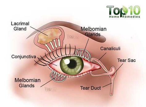 dry eye diagram Dry Eye Remedies, Dry Eyes Causes, Dry Eye Symptoms, Top 10 Home Remedies, Eye Exercises, Dry Eye, Vision Eye, Eyes Problems, Hair Solutions