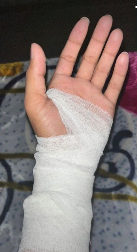 Fake Wounds Photo Hand, Hat Kata Pic Real Blad, Hat Kata Pic, Burned Hand Pic, Bandage Hand, Bandaged Hands, Cut Pic, Medicine Snaps, Attitude Bio For Instagram