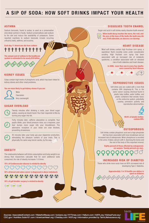 How a Sip of Soda Affects Your Health (Image) Fitness Lady, Health Images, Body Fitness, Body And Mind, Detox Smoothie, Health Info, Health Products, Soft Drinks, Alternative Medicine