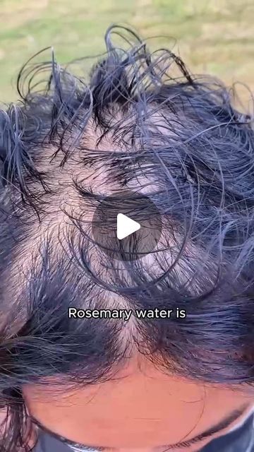 Rosemary Oil Recipe, Thining Hair, Rosemary Water, Hair Growth For Men, Rosemary Oil For Hair, How To Grow Your Hair Faster, Hair Growing Tips, Bald Hair, Diy Hair Care