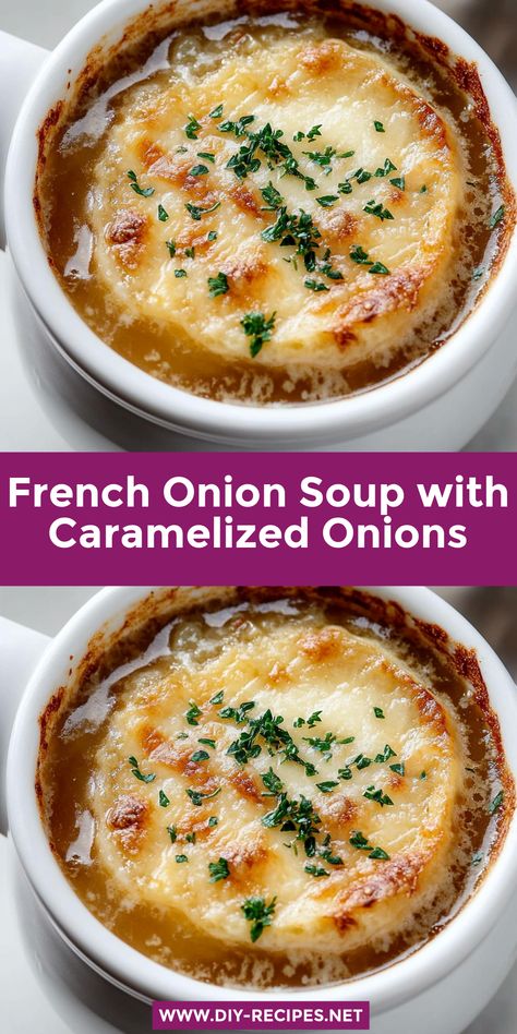 This French Onion Soup recipe is all about the rich caramelized onions! Topped with cheesy toasted bread, it’s the perfect cozy dish for cold days. Simple Onion Soup, French Onion Soup With Brandy, French Onion Soup Gluten Free, Irish Onion Soup, French Onion Soup With Chicken, Rich French Onion Soup, French Onion Soup Casserole Recipe, Erin French Recipes, French Onion Soup No Wine