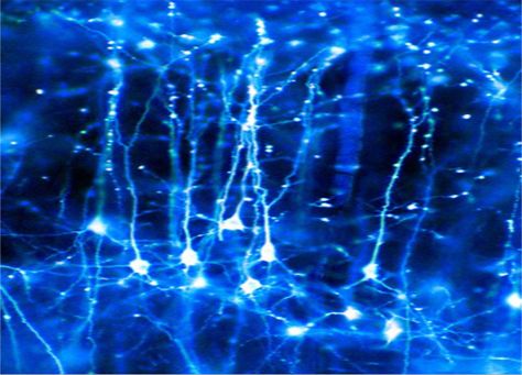 Neurons Brain Neurons, Cerebral Cortex, Rhapsody In Blue, Nerve Cell, E Mc2, Brain Activities, To Infinity And Beyond, Anatomy And Physiology, Feeling Blue