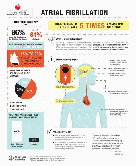 Learn more about atrial fibrillation, how it affects your how and increases your risk of stroke. Nursing Board, Nursing Mnemonics, Cardiac Nursing, Nurse Rock, Atrial Fibrillation, Nursing Tips, Future Nurse, Emergency Medicine, American Heart Association