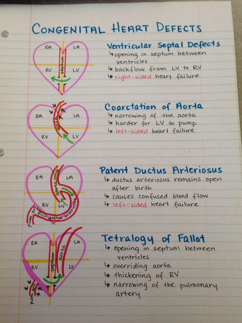 Congenital Heart Defects #NCLEXprep #NursingStudent Penyakit Jantung, Nursing Mnemonics, Medical Student Study, Nursing School Survival, Congenital Heart, Nursing School Studying, Nursing School Tips, Nursing School Notes, Medical School Studying