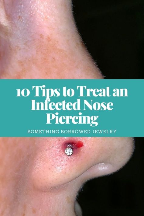 10 Tips to Treat an Infected Nose Piercing Infected Nose Ring, Nose Ring Bump, Nose Piercing Infection, Infected Ear Piercing, Nose Infection, Nose Piercing Pain, Nose Piercing Care, Nose Piercing Tips, Nose Piercing Healing