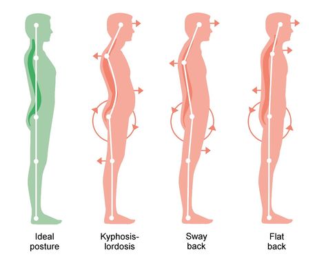 Fix Forward Head Posture with Pandiculation - Somatic Movement Center Physical Therapy Quotes, Somatic Movement, Forward Head Posture Exercises, Increase Height Exercise, Neck And Shoulder Muscles, Forward Head Posture, Body Connection, Posture Exercises, Receding Gums