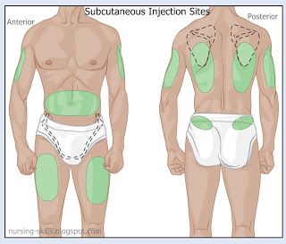 Sub Q Injection Sites Injection Sites Nursing, Injection Sites, Nursing Pharmacology, Subcutaneous Injection, Nursing Skills, Nursing Cheat, Nursing Information, Nursing Fun, Nurse School