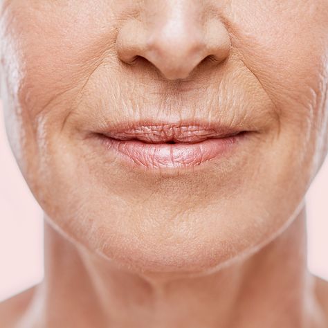 Mouth Wrinkles, Upper Lip Hair, Lev Livet, Lip Wrinkles, Botox Injections, Lip Hair, Smooth Lips, Anti Aging Tips, Upper Lip