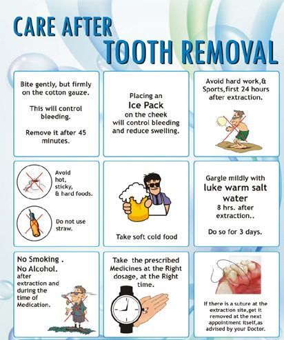 Dental Terminology Dentistry, Wisdom Teeth Removal Food, Dental Quiz, Dental Terminology, Wisdom Teeth Recovery, Dental Ads, Tooth Extraction Aftercare, Tooth Extraction Healing, Teeth Surgery