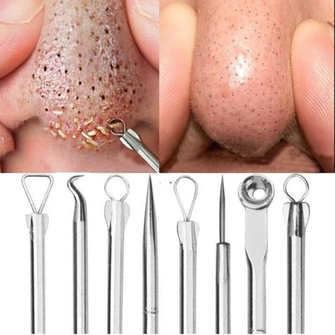 5 Pcs Set - Blackhead Whitehead Pimple Spot Comedone Acne Extractor Remover Popper Tool Kit Underarm Pimples, Pimple Popper Tool, Pimple Removal, Rosebud Salve, Blind Pimple, Pimples Under The Skin, Dior Addict Lip Glow, Prevent Pimples, Mole Removal