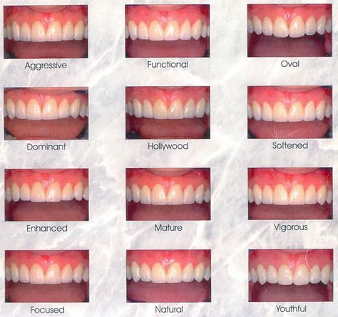 K9 Teeth Human Aesthetic, K9 Teeth Human, Types Of Teeth Shapes, Braces Guy, Teeth Inspiration, Different Types Of Teeth, Shiny Teeth, Loose Teeth, Dental Smile