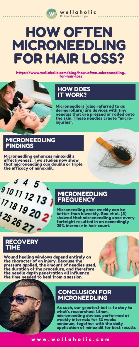 The Secret to Thicker, Healthier Hair: How Often to Microneedle for Hair Loss Microneedling Hair Growth, Microneedling For Hair Growth, Androgenic Alopecia, Thicker Healthier Hair, Low Level Laser Therapy, Thicker Fuller Hair, Business Baby, Hair Roots, Boost Hair Growth