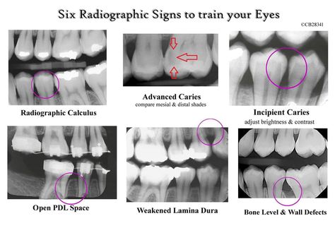 Dental Assistant Study Guide, Registered Dental Assistant, Dental Assistant School, Dental Hygienist School, Dental Assistant Study, Dental Hygiene Student, Kedokteran Gigi, Kesehatan Gigi, Dental Hygiene School