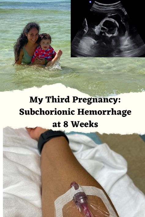 My Third Pregnancy: Subchorionic Hemorrhage at 8 Weeks (First trimester symptoms) – Mama West Subchorionic Hemorrhage, First Trimester Symptoms, 8 Weeks Pregnant, Pregnancy Help, Third Pregnancy, 1st Trimester, First Blood, Second Trimester, Trimesters Of Pregnancy