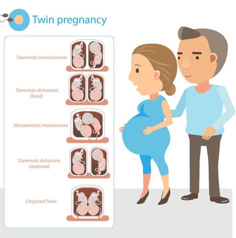 Momo Twins, Pregnancy Twins, Twin Pregnancy Belly, Types Of Twins, Prenatal Development, Getting Pregnant With Twins, Mom Checklist, Mother Of Twins, Twins Pregnancy