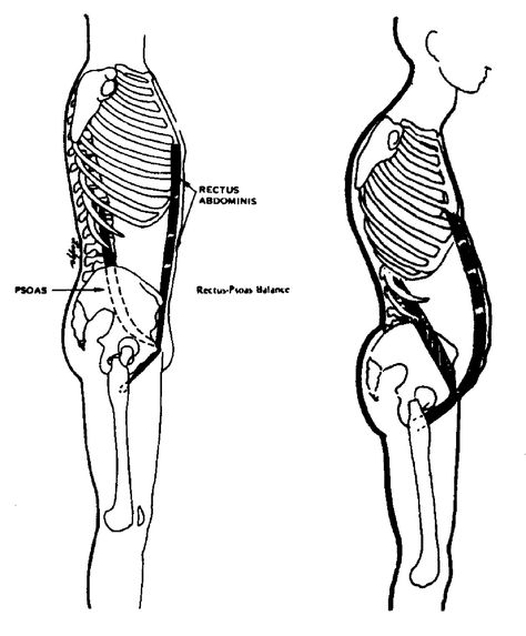 The Psoas Major and Sit Ups Psoas Major, Rectus Abdominis Muscle, Rectus Abdominis, Psoas Release, Hip Problems, Pot Belly, Tight Hip Flexors, Spine Health, Psoas Muscle