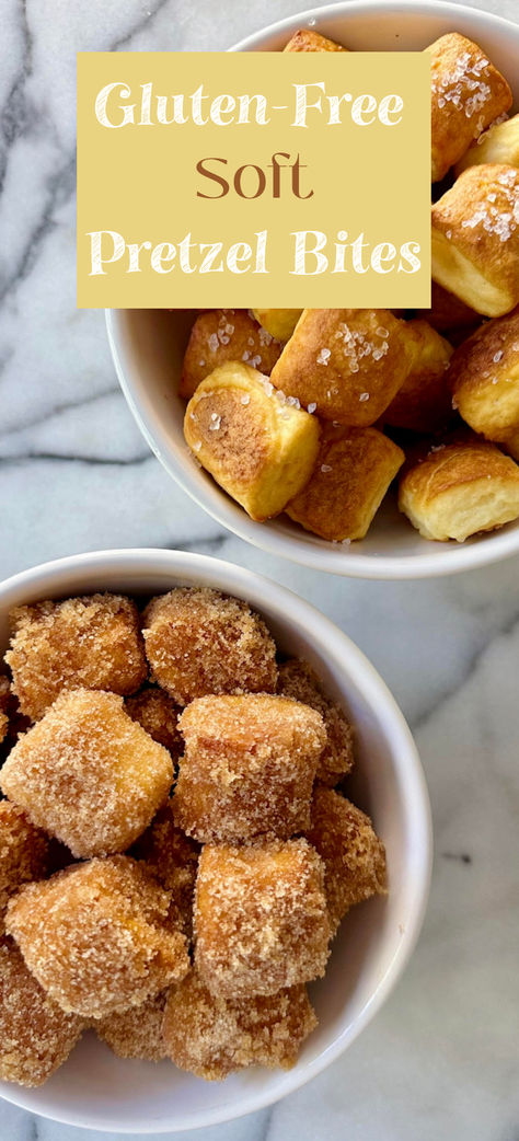 Golden, soft & chewy, and irresistibly delicious whether you choose to serve them salted or with cinnamon sugar! Not only do these Gluten-Free Soft Pretzel Bites have a perfect texture and flavor, but they are incredibly quick + easy to make! Perfect for Game Day, snacking and sharing! Gluten Free Soft Pretzels, Soft Pretzel Bites, Pretzel Bites Recipes, Gluten Free Pretzels, Easy Gluten Free Desserts, Dairy Free Snacks, Cookies Gluten Free, Gluten Free Appetizers, Soft Pretzel