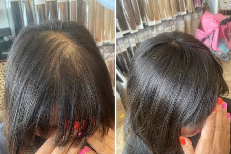 Hairstyles To Hide Thinning Crown, Hair Colour For Thinning Hair, Style Thinning Hair Women, Balding Hairstyles Women, How To Hide Thinning Hair For Women, Haircuts For Thinning Crown Women, Thinning Hair Women Haircuts, Hairstyles For Loss Of Hair, Hairstyle Thinning Hair Women