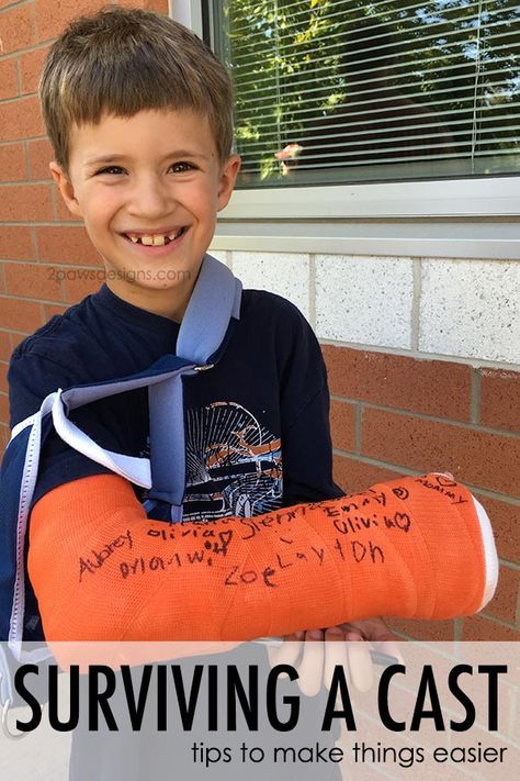 Broken arm? Here are our tips for surviving a cast and making life a little easier while waiting on the bones to heal. Broken Arm Cast, Broken Arm Gift, Cast Covers Arm, Signing Ideas, Cast Decoration, Kids Cast, Get Well Baskets, Long Leg Cast, Arm Cast