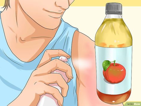 Sunburn Itch Relief, Heal Sunburn Fast, Sunburn On Face, Vinegar For Sunburn, Best For Sunburn, Sunburn Face, Sunburn Blisters, How To Help Sunburn, Home Remedies For Sunburn