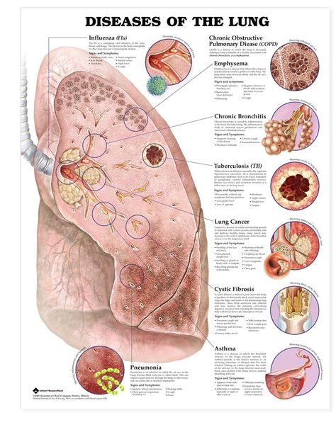 Lung Anatomy, Anatomy Poster, Body Diagram, Pulmonology, Medical Student Study, Respiratory Care, Nursing School Survival, Respiratory Therapy, Nursing School Studying