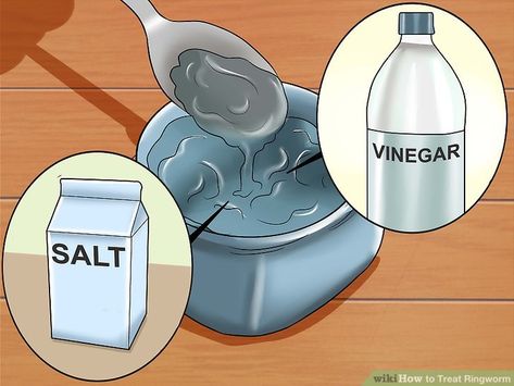 How to Treat Ringworm (with Pictures) - wikiHow Fingernail Fungus, Toenail Fungus Remedies, Fiberglass Shower, Bronze Fixtures, How To Clean Rust, Fungal Nail, Bathtub Drain, Toenail Fungus, Nail Fungus