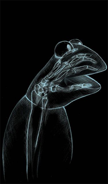 Puppet Check Up: After receiving an x-ray, he finally figured out what was ailing him: By Joshua Kemble Die Muppets, Funny Commercial Ads, Funny Commercials, Funny Ads, Kermit The Frog, Wow Art, Jim Henson, Photo Images, Alternative Medicine