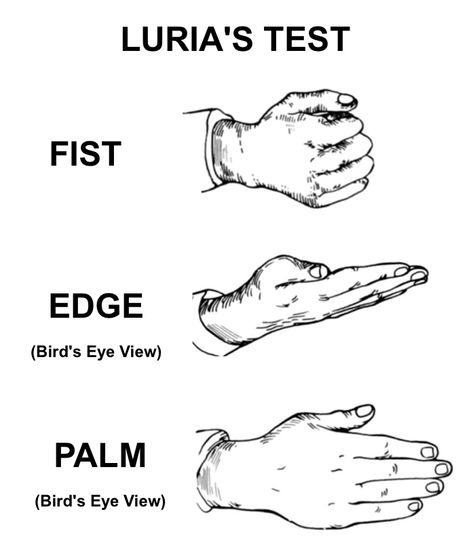 Luria Sequence (Luria's Test) Primer Luria's Test (“fist-edge-palm” test or Luria Sequence) is a task that requires a patient to imitate three hand motions performed by a clinician. Luria's test is part of the Frontal Assessment Battery (FAB) battery of tests. Luria's test assesses for frontal lobe (i.e. - executive) dysfunction or damage, as patients will often have difficulty with fine motor skills and sequencing motor skills. Specifically, it is designed to assess different aspects of execu Executive Dysfunction, Motor Planning, Frontal Lobe, Working Memory, Three Hands, Fine Motor Skills, Fine Motor, Motor Skills, Assessment