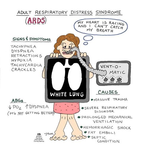 Acute Respiratory Distress Syndrome (a.k.a.: Noncardiogenic Pulmonary Edema, Adult Respiratory Distress Syndrome, Shock Lung) Respiratory Distress, Nursing Information, Nursing Mnemonics, Surgical Nursing, Medical Surgical Nursing, Respiratory Care, Nursing School Survival, Critical Care Nursing, Respiratory Therapy