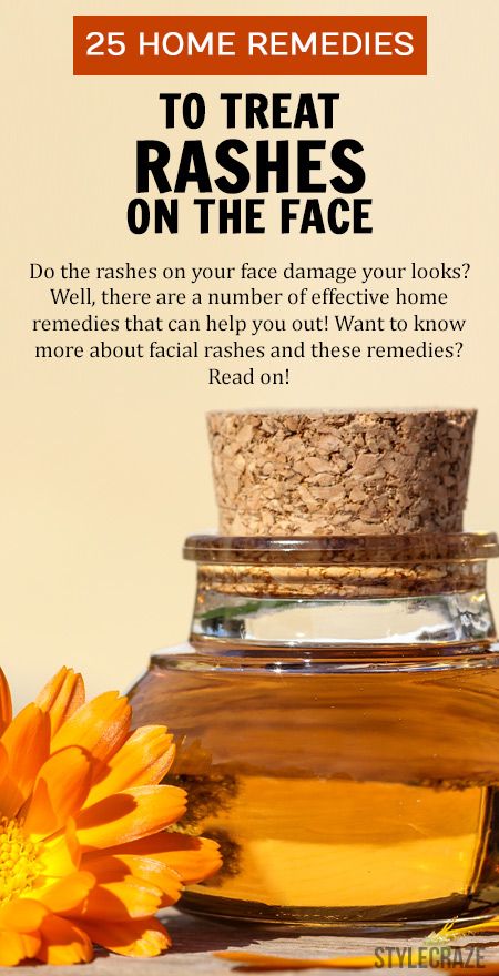 Do the rashes on your face damage your looks? ...  #SkinCare Face Rash Remedies, Skin Rash Remedies, Home Remedies For Rashes, Home Remedies For Face, Sagging Skin Remedies, Rash On Face, Rashes Remedies, Home Remedies For Skin, Natural Acne Remedies