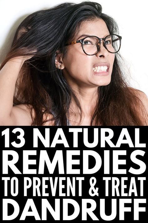 13 Home Remedies for Dandruff | Dry scalp got you down? If you want to know how to get rid of dandruff and the flakes it brings along with it without harsh chemicals and store bought products, we’re sharing 6 homemade remedies you can start using today for results that last. Using things you already have on hand, like baking soda, coconut oil, and aloe vera, these natural treatments work! #dandruff #dandruffremedies #dryscalp Dry Scalp Treatment Diy, What Causes Dandruff, Dry Scalp Remedy, Natural Dandruff Remedy, Hair Mask For Dandruff, Dandruff Causes, Home Remedies For Dandruff, Dry Scalp Treatment, Dandruff Remedy