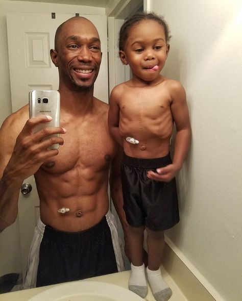 Dad Creates a Fake Feeding Tube to Support Sick Toddler: "He'll Never Be in the Fight Alone" Feeding Tube Awareness, Sick Toddler, Congenital Heart Defect, Heart Defect, Congenital Heart, Becoming A Father, Feeding Tube, Learn How To Knit, Leg Day