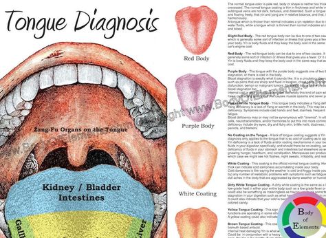 Chinese Tongue Diagnosis Poster 24 X 36 Traditional Chinese Medicine Acupuncture Ayurvedic Map Chart Paper or Laminated - Etsy Medicine Poster, Vitamin D Deficiency Symptoms, Traditional Chinese Medicine Acupuncture, Native American Medicine Wheel, Chart Paper, Red Tongue, Low Estrogen Symptoms, Healthy Life Hacks, Beauty Diet