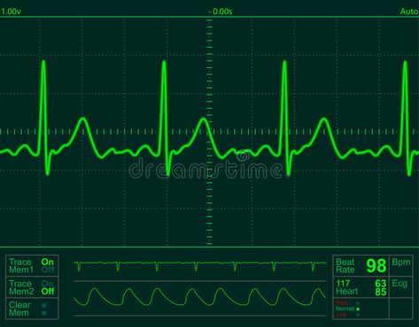 Heart monitor screen. With normal beat signal #Sponsored , #AD, #Ad, #monitor, #signal, #beat, #Heart Human Heart Facts, Anatomy Website, Dystopian Concept Art, Normal Ecg, Future Museum, King And Queen Pictures, Heart Facts, Medical Clip Art, Heartbeat Monitor