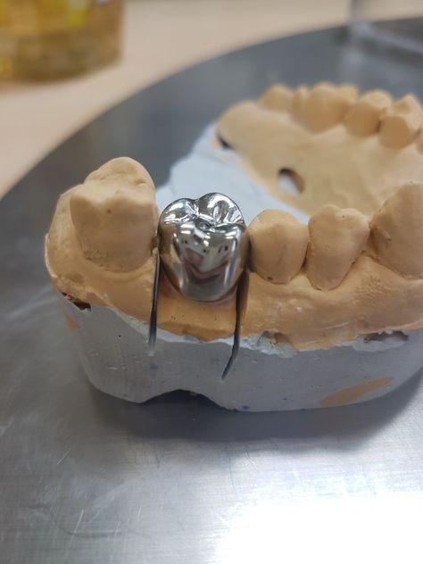 #metal crown #teeth #dental technician Crown Teeth, Dental Wallpaper, Dental Fun, Dental Technician, Dental Braces, Metal Crown, People Smile, Dental Hygienist, Dream Job