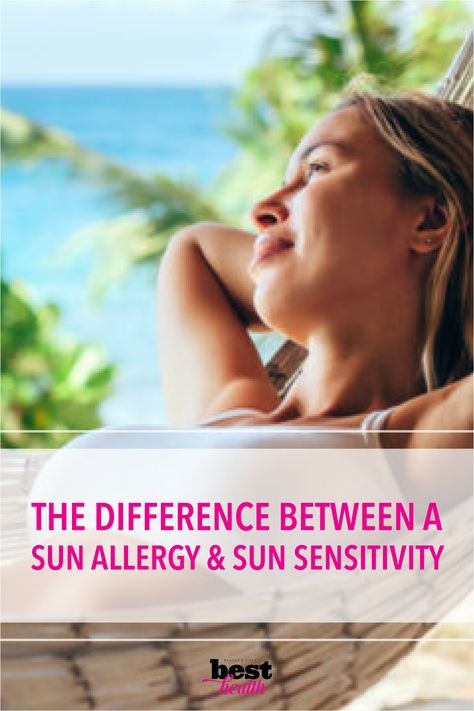 Sun Allergy Remedies, Sun Allergy Rash, Swelling Remedies, Sun Sensitivity, Summer Allergies, Allergy Rash, Sun Allergy, Spring Skin, Allergy Season