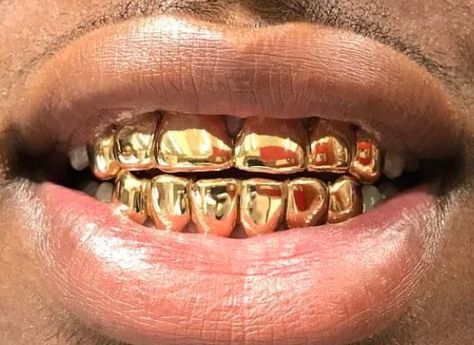 Permanent Gold Teeth, Gold Slugs, Gold Teeth Grills, Jewelry Teeth, Grillz Teeth, Gold Grill, Diamond Teeth, Gold Grillz, Grills Teeth