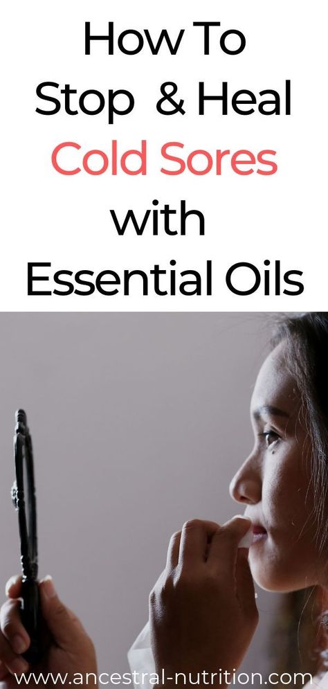 How to stop and heal cold sores using Essential Oils! This is the most effective and most natural way of getting rid of nasty cold sores caused by Herpes Simplex Virus 1 #coldsores #health #beauty #remedies #essentialoils Essential Oils For Cold Sores On Lip, Diy Cold Sore Remedy Fast, How To Get Rid Of Cold Sores Overnight, Cold Sore Remedy Overnight, Essential Oils For Cold Sores, Cold Sore Essential Oil, Cold Sore Remedy, Essential Oil Blends For Colds, Natural Cold Sore Remedy